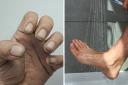 Finger nails and legs were among the places not being washed enough by people in the shower, according to a doctor on TikTok.